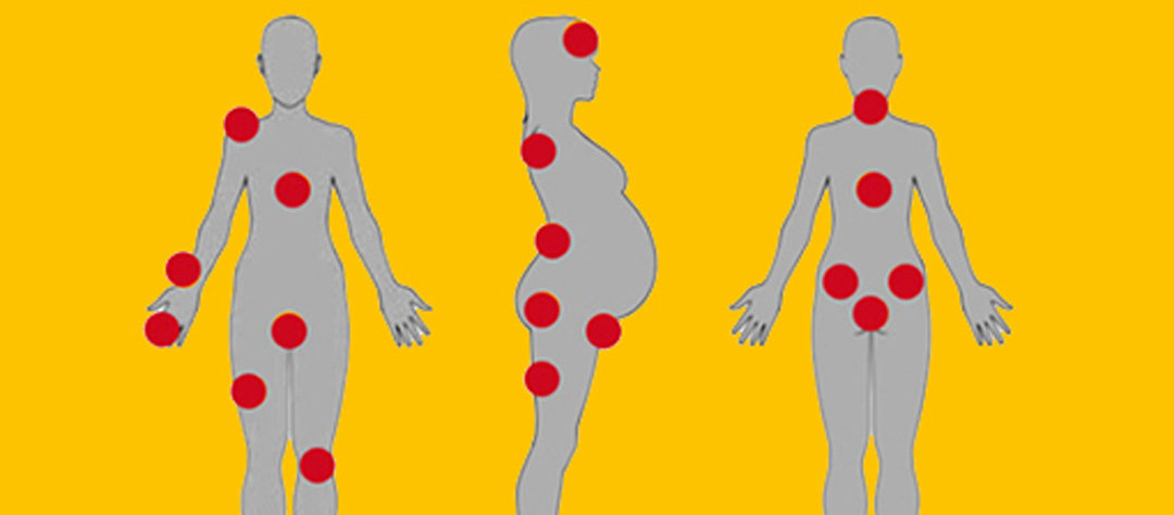 Rygg och Bäckensmärta – frågor och dokument